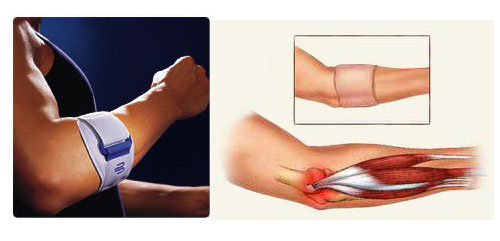 bandaged arm and anatomical diagram of arm tendons